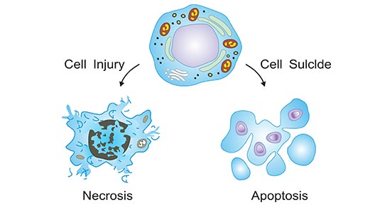 The two ways of cell death