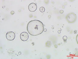 Human Tumor-Derived Organoids-Hepatobiliary carcinoma organoids