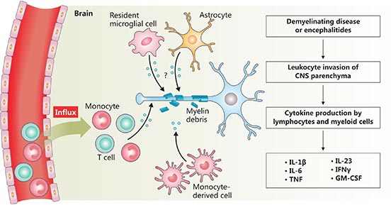 The diagram of neuroinflammation