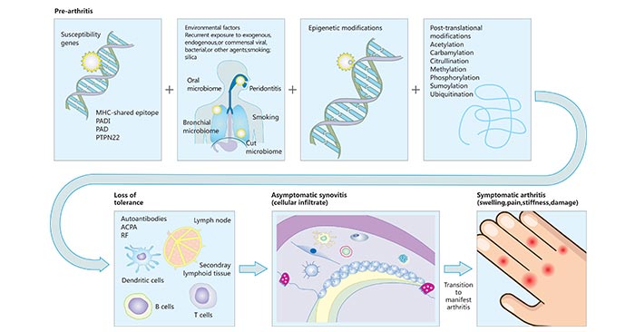 : Pathways to rheumatoid arthritis