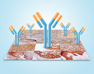 Immunohistochemistry (IHC) Antibodies