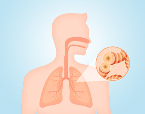 Asthma