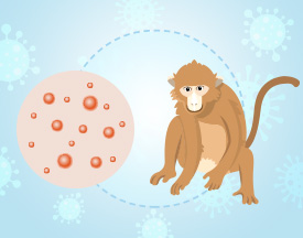 Monkeypox