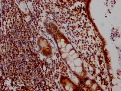 CSB-RA231179A0HU IHC