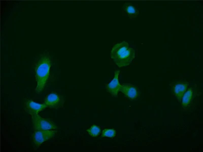 CSB-RA589492A0HU IF