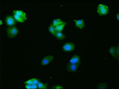 CSB-RA008585A0HU IF