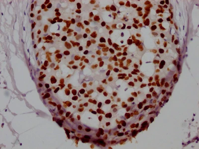 CSB-RA008585A0HU IHC