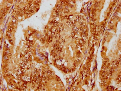 CSB-RA008642MA1HU IHC