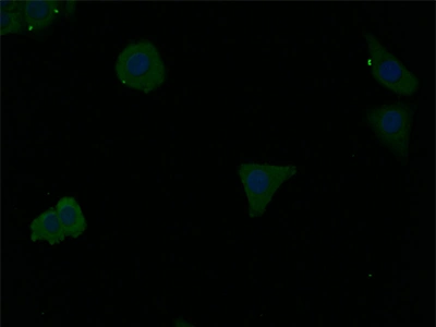 CSB-RA940669A0HU IF