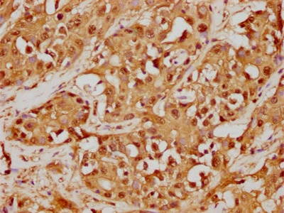CSB-RA009986A0HU IHC