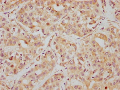 CSB-RA010242A0HU IHC