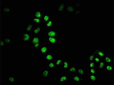 CSB-RA010245A0HU IF