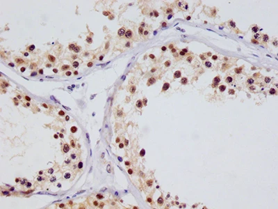 CSB-RA256295A0HU IHC