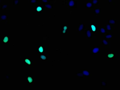 CSB-RA010418A0HU IF