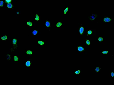 CSB-RA792403A0HU IF
