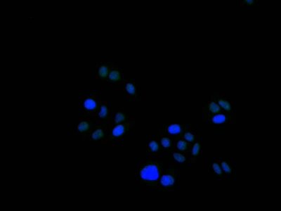CSB-RA010418A0HU IF