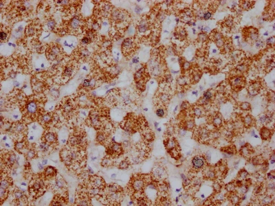 CSB-RA010611A0HU IHC