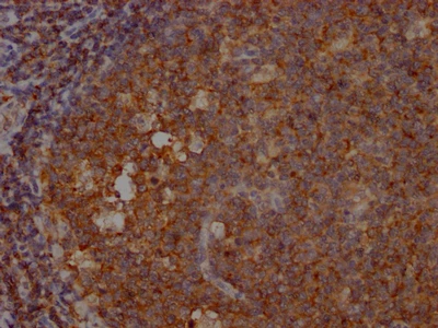 CSB-RA904894A0HU IHC