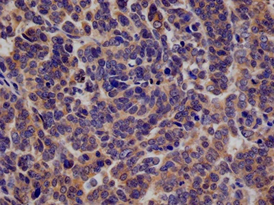 CSB-RA869779A0HU IHC