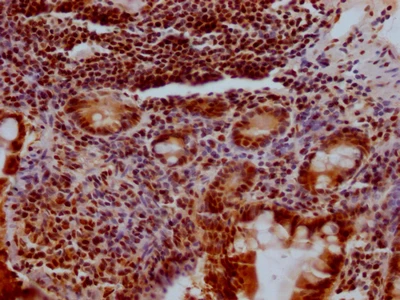 CSB-RA194949A0HU IHC