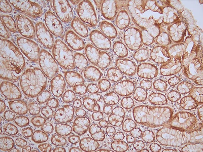 CSB-RA984568A0HU IHC