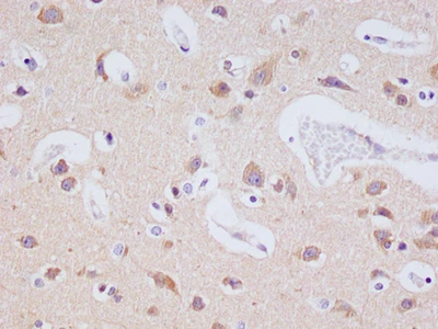 CSB-RA240216A0HU IHC