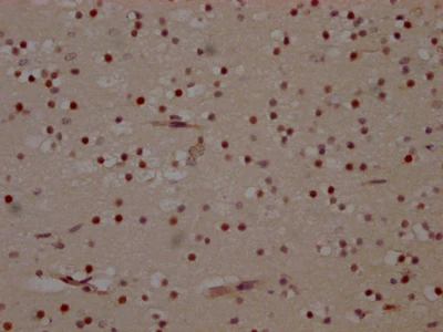 CSB-RA236860A0HU IHC