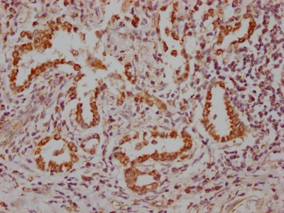 CSB-RA181189A0HU IHC