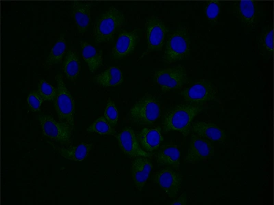 CSB-RA926985A0HU IF