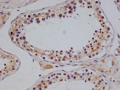 CSB-RA832492A0HU IHC