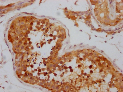 CSB-RA995655A0HU IHC