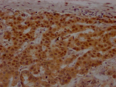CSB-RA581794A0HU IHC
