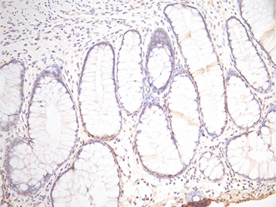 CSB-RA017739MA1HU IHC