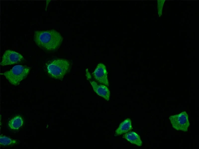 CSB-RA197122A0HU IF