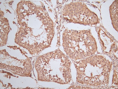 CSB-RA191819A0HU IHC