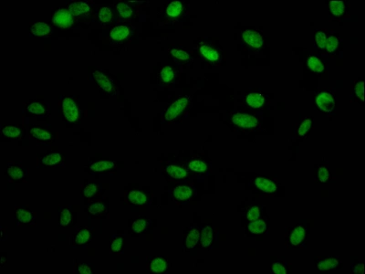CSB-RA915915A0HU IF