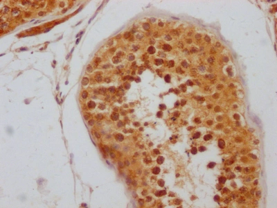 CSB-RA227095A0HU IHC