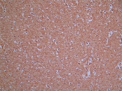 CSB-RA896760MA1HU IHC