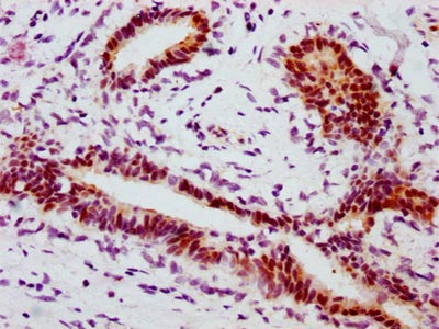 Phospho-STAT1 (S727) Recombinant Monoclonal Antibody