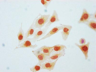 Phospho-CDK2 (Y15) Recombinant Monoclonal Antibody