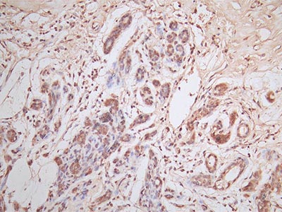 ERBB2 Recombinant Monoclonal Antibody