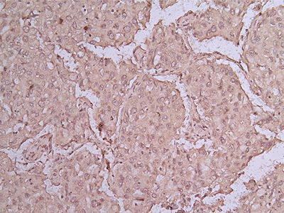 EGFR Recombinant Monoclonal Antibody