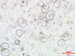 Human Normal-Derived Organoids-Uterine organoids