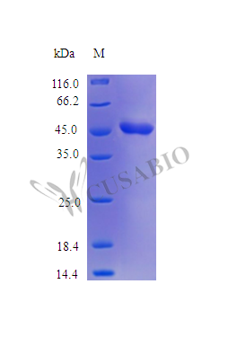Recombinant Streptococcus sp Streptokinase G protein (skg) (Active) Recombinant Streptococcus sp Streptokinase G protein (skg) (Active)