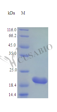 Recombinant Rat Cardiotrophin-1 protein (Ctf1) (Active) Recombinant Rat Cardiotrophin-1 protein (Ctf1) (Active)