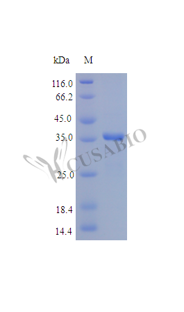 Recombinant Human SPARC protein (SPARC) (Active) - image 1