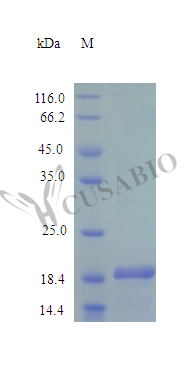 Recombinant Human Desert hedgehog protein (DHH), partial (Active) Recombinant Human Desert hedgehog protein (DHH), partial (Active)