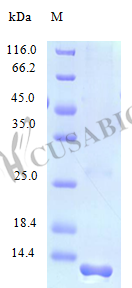 Recombinant Human Protein FAM19A2 protein (FAM19A2) (Active) Recombinant Human Protein FAM19A2 protein (FAM19A2) (Active)
