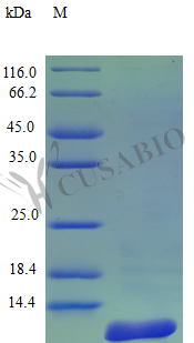 Recombinant Rhesus Macaque Amyloid protein A protein (SAA1) (Active) Recombinant Rhesus Macaque Amyloid protein A protein (SAA1) (Active)