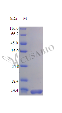 Recombinant Rat C-C motif chemokine protein (Ccl28) (Active) Recombinant Rat C-C motif chemokine protein (Ccl28) (Active)